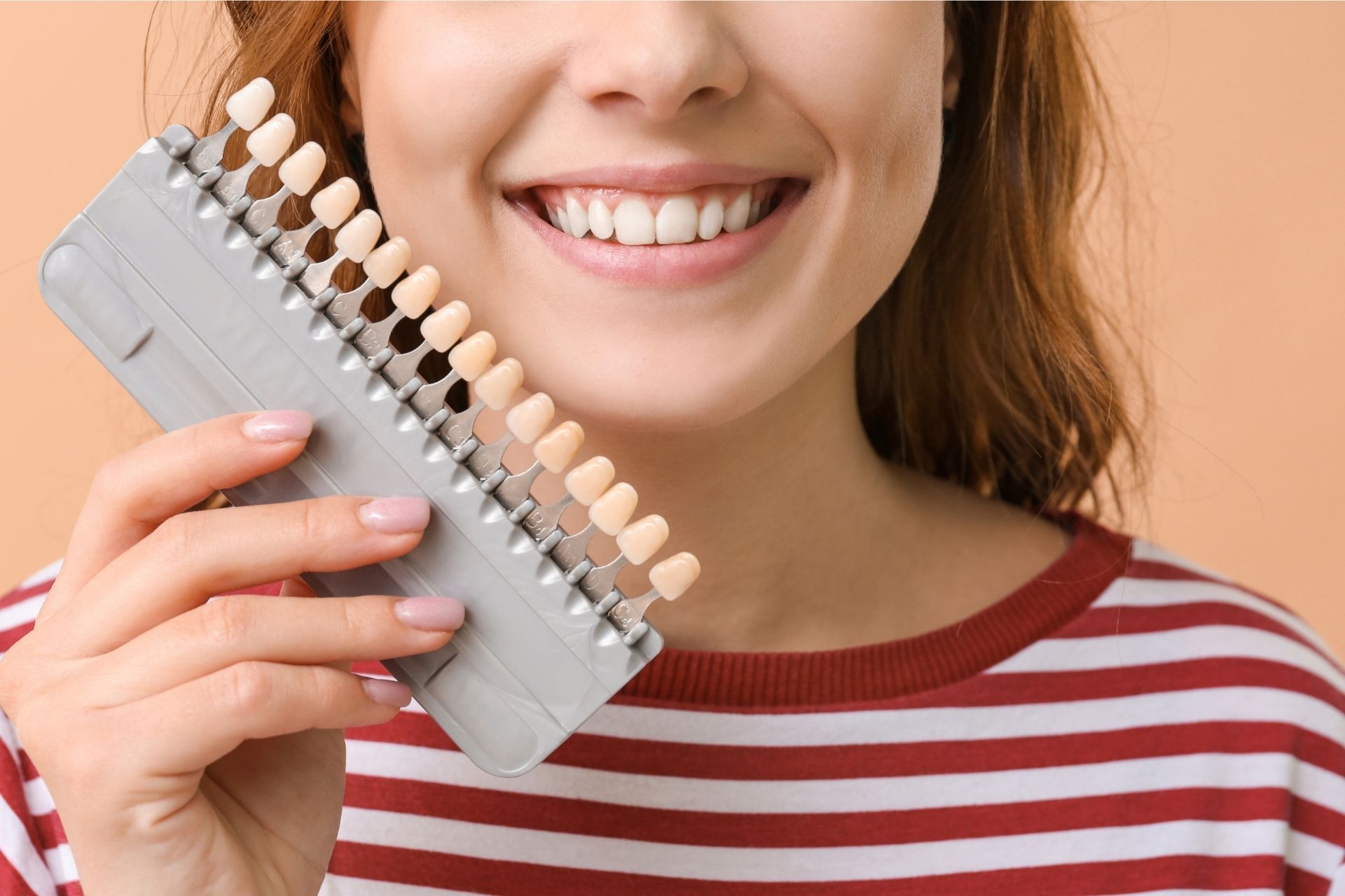 What are veneers - dentist in Brampton - Dentistry On Main